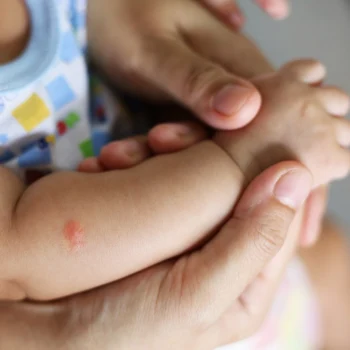 Sposoby na komary dla dzieci - klasyczne metody czy gotowe środki?