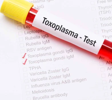 Toksoplazmoza a ciąża – wszystko, co warto wiedzieć