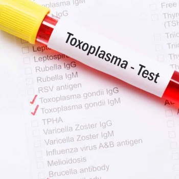 Toksoplazmoza a ciąża – wszystko, co warto wiedzieć