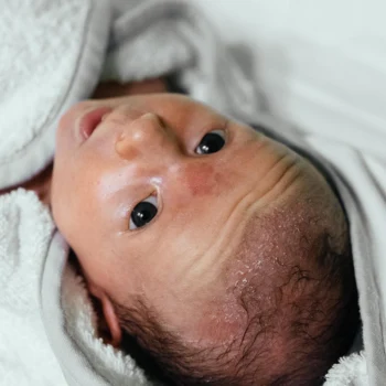 Domowe sposoby na ciemieniuchę u dzieci i niemowląt