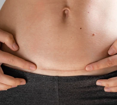 Powrót do zdrowia i formy po cesarce