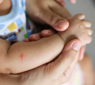 Sposoby na komary dla dzieci - klasyczne metody czy gotowe środki?